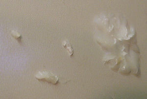 ShapeLock melted and bonded to a plastic binder cover.